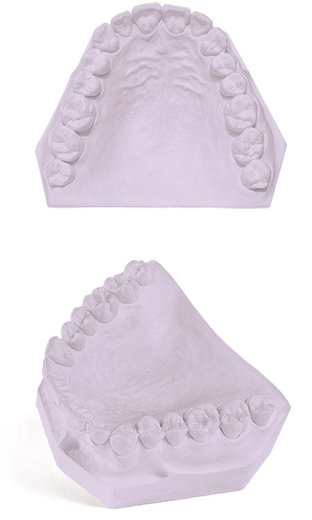 Dental Excalibur Die Stone