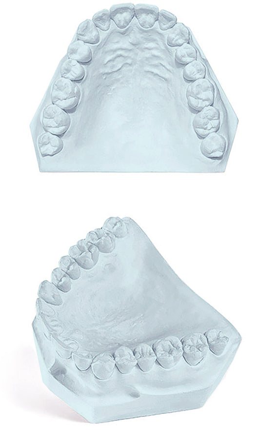 Excelsior Resin Die Stone