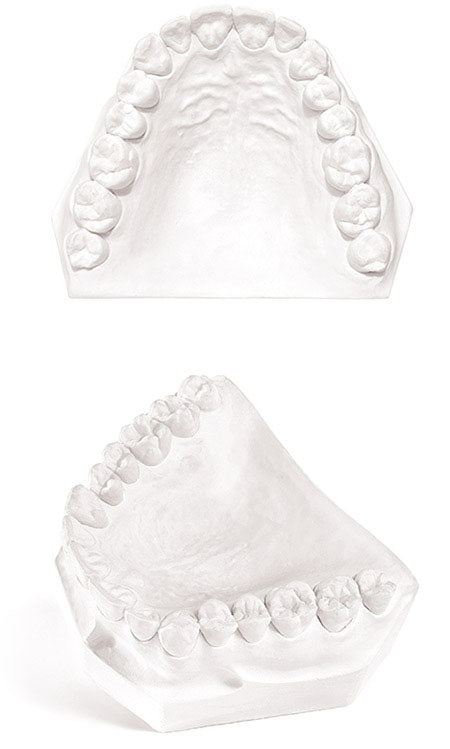 Dental Plaster Type II